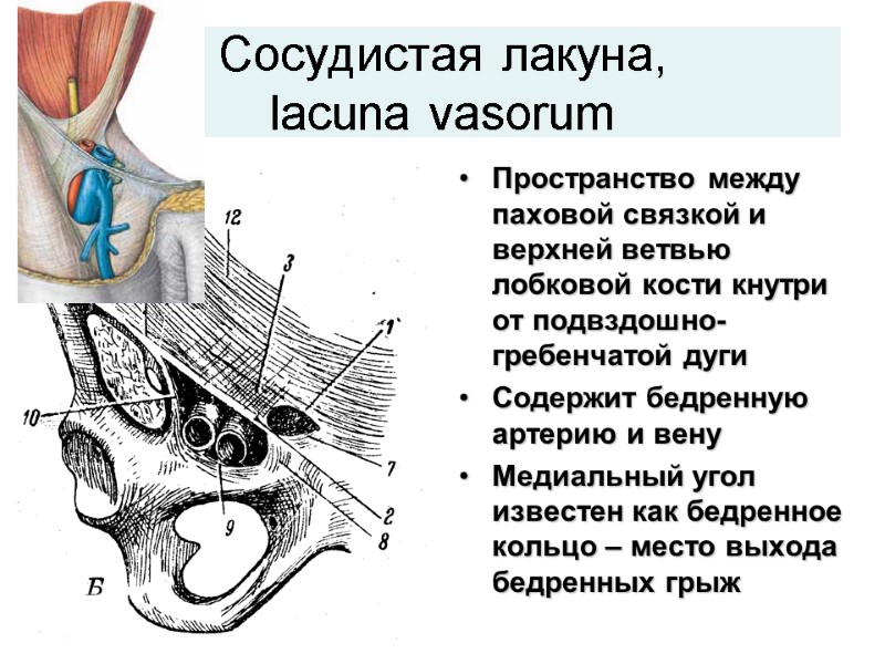 Сосудистая лакуна,  lacuna vasorum Пространство между паховой связкой и верхней ветвью лобковой кости